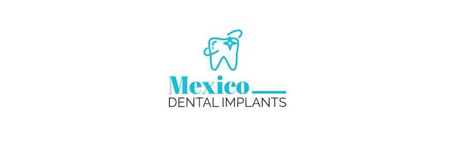 Mexico Dental Implants Cover Image