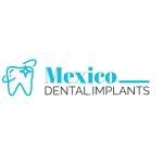 Mexico Dental Implants Profile Picture