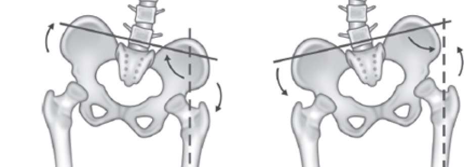 Pelvic Leveler Cover Image