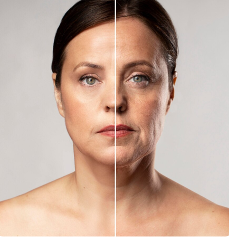 Smooth, Youthful Skin with Botox and Wrinkle Reduction: revivedbody — LiveJournal