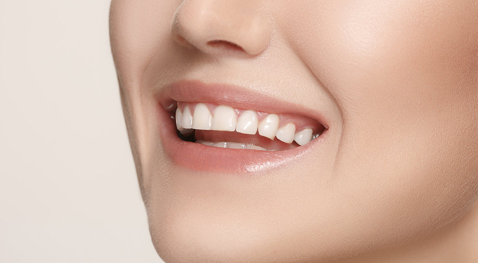 How Crest 3D White Transforms Your Smile in Just Days