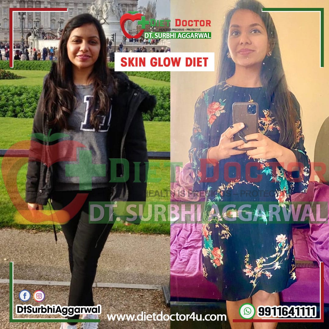 Best Dietician in Pitampura | Personalized Nutrition Plans