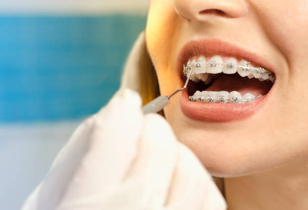 When to Visit the Orthodontist? Indications You May Need to Schedule a Visiting : goorthodontics — LiveJournal