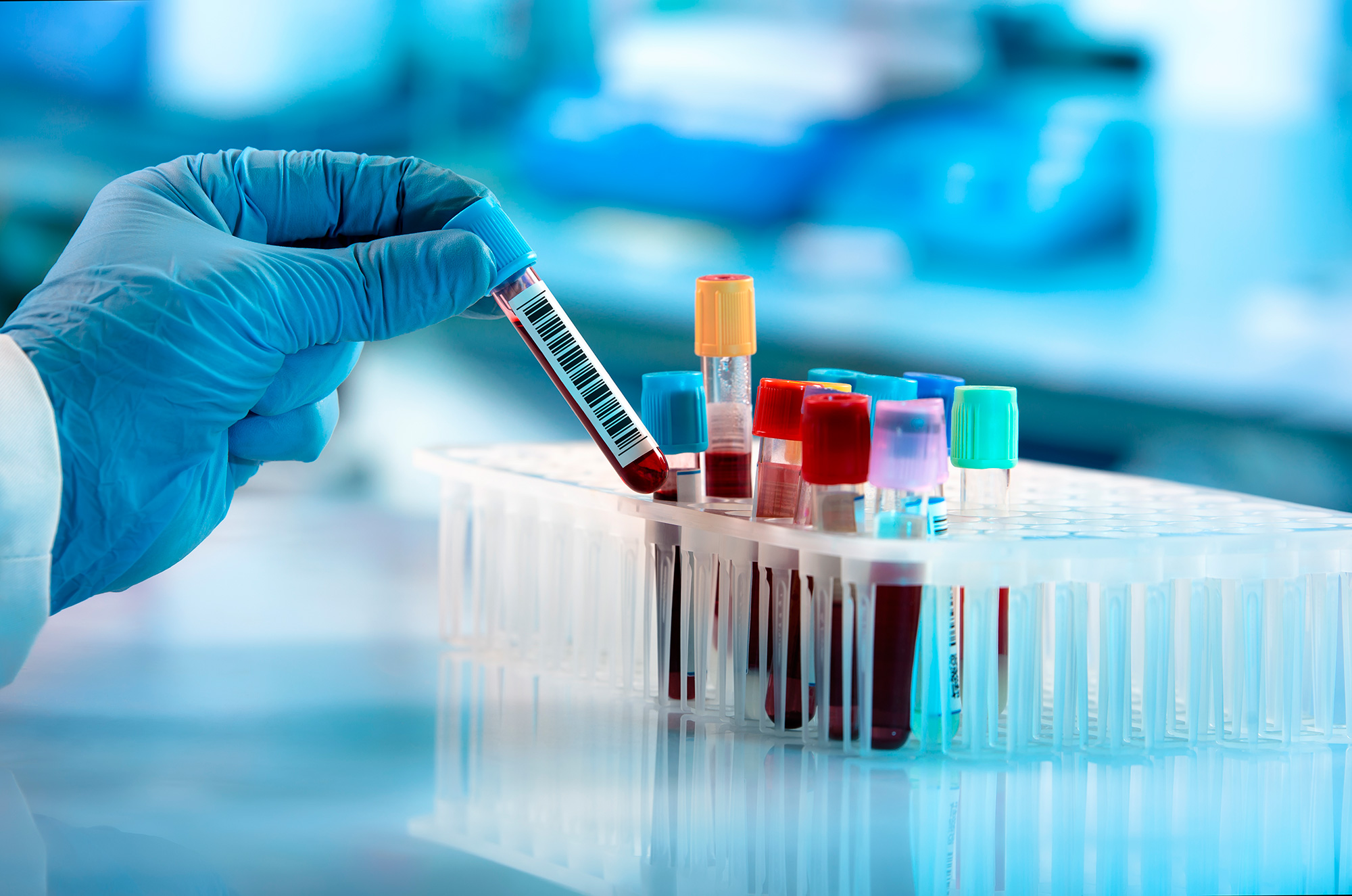 Types of Blood Tests Available at Home