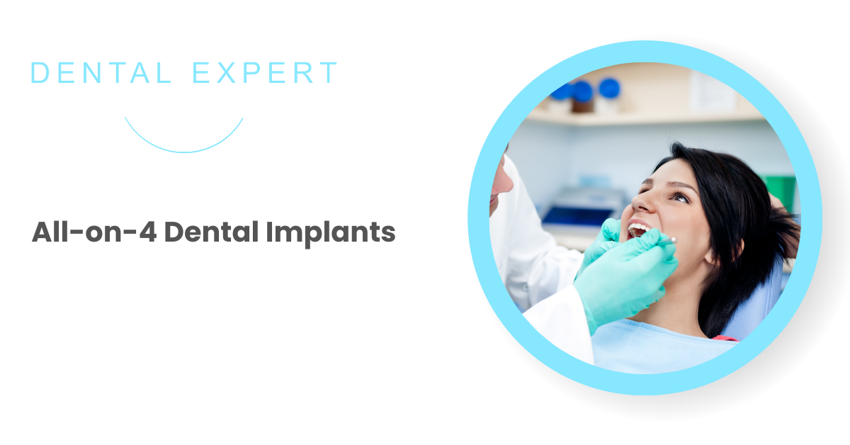 What are All-on-4 Dental Implants? | Dental Expert