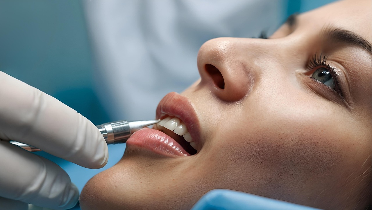 Frenectomy in Massapequa & Long Island | Expert Care