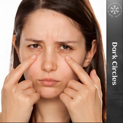Dark Circles Treatment in Islamabad Pakistan - ERC - PK