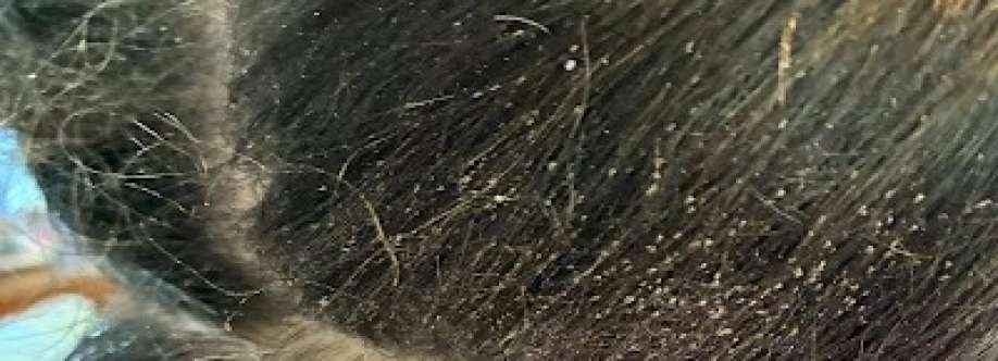 Lice Ever After Cover Image