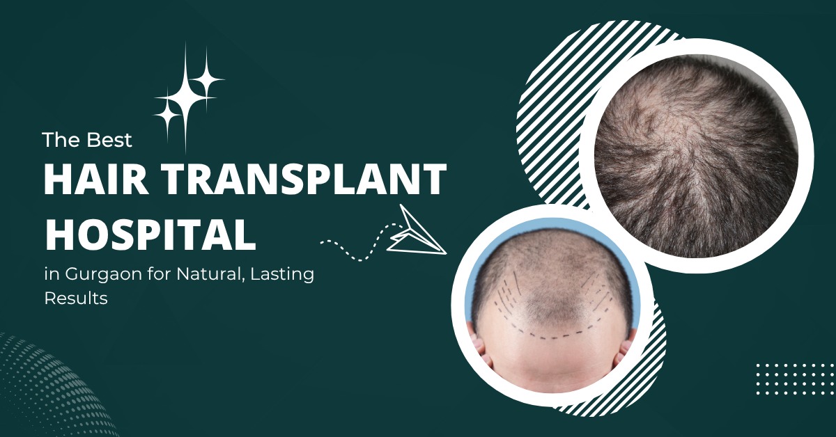Best Hair Transplant Hospital in Gurgaon | Mahendra Hair and Skin